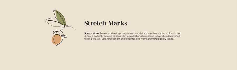 STRETCH MARKS