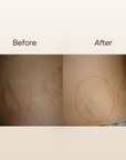 Jojo E Stretch Mark Serum 50ml (CLEARANCE SALE EXP: 11/2026)