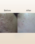 Natur E Scar Serum