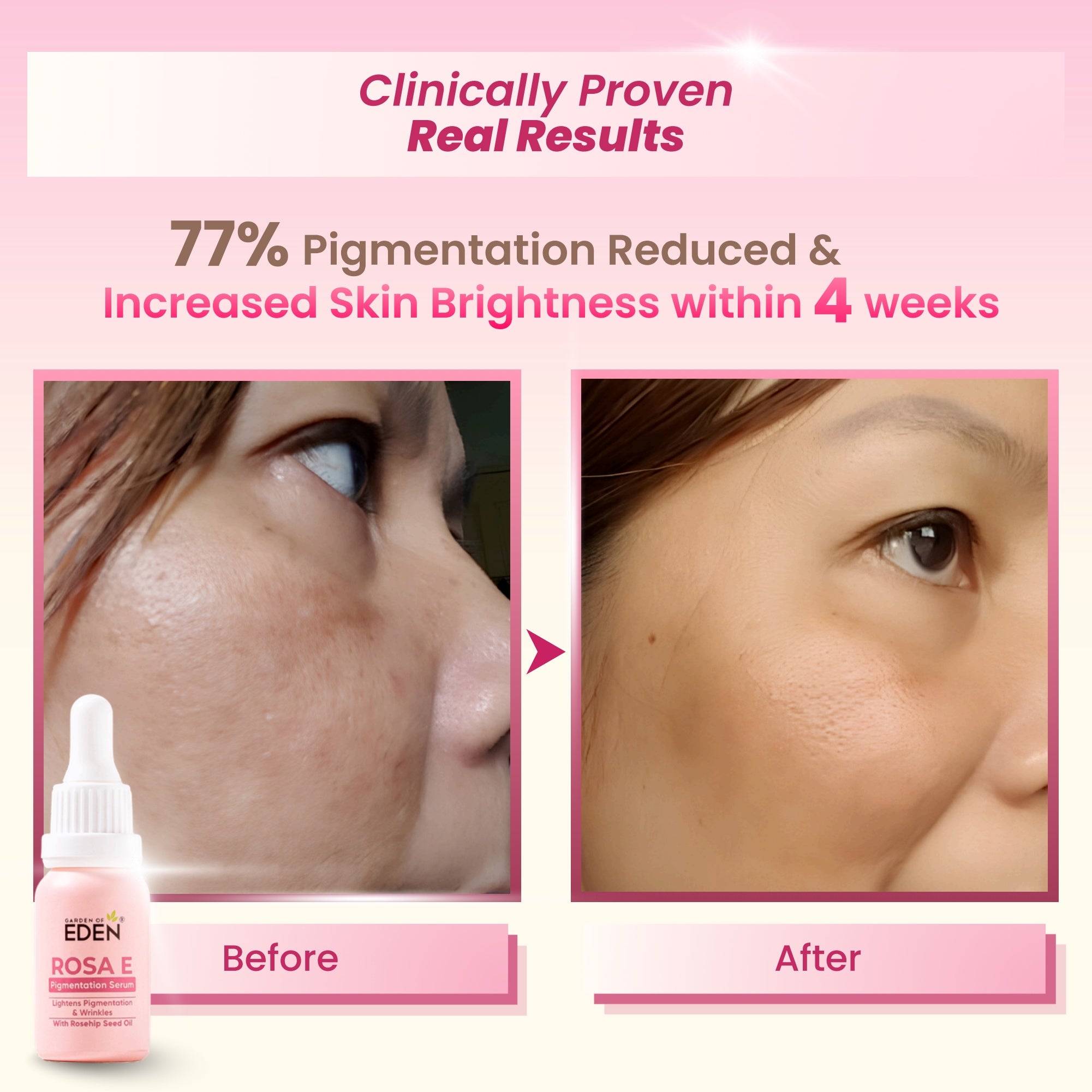 Rosa E Pigmentation Serum 15ml