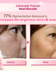 Rosa E Pigmentation Serum 15ml