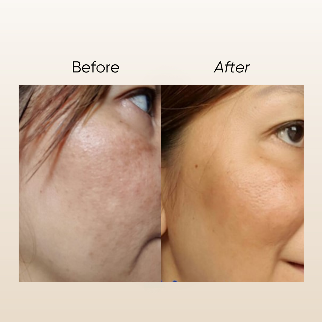 Rosa E Pigmentation Serum 15ml (CLEARANCE SALE EXP: 02/2027)