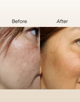 Rosa E Pigmentation Serum 15ml