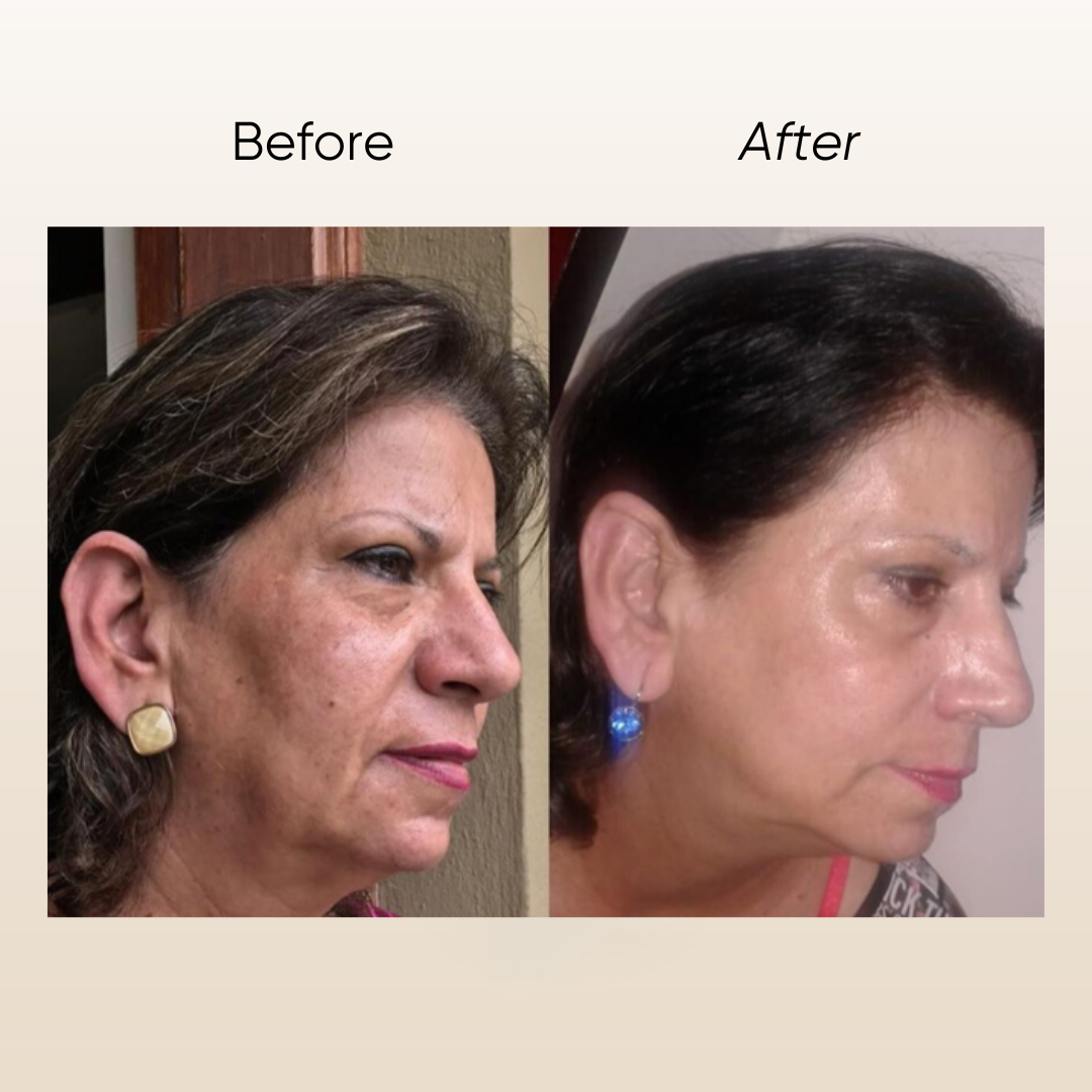 Rosa E Pigmentation Serum 15ml