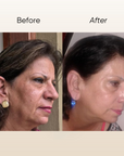 Rosa E Pigmentation Serum 15ml